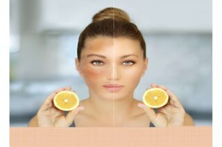 Tan Removal Home Remedy