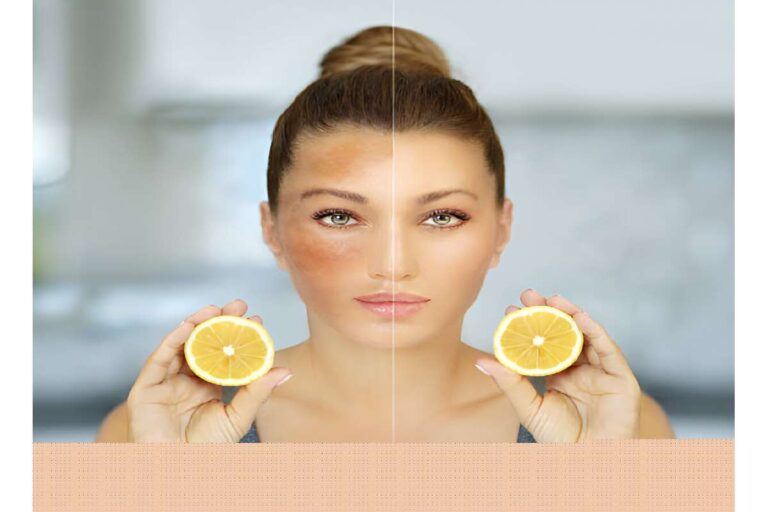 Tan Removal Home Remedy